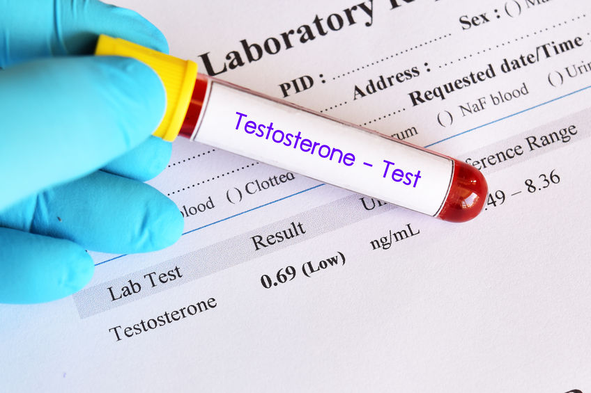 Testosterone Testing